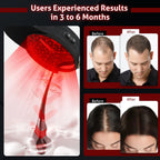Red Light Hair Regrowth Cap