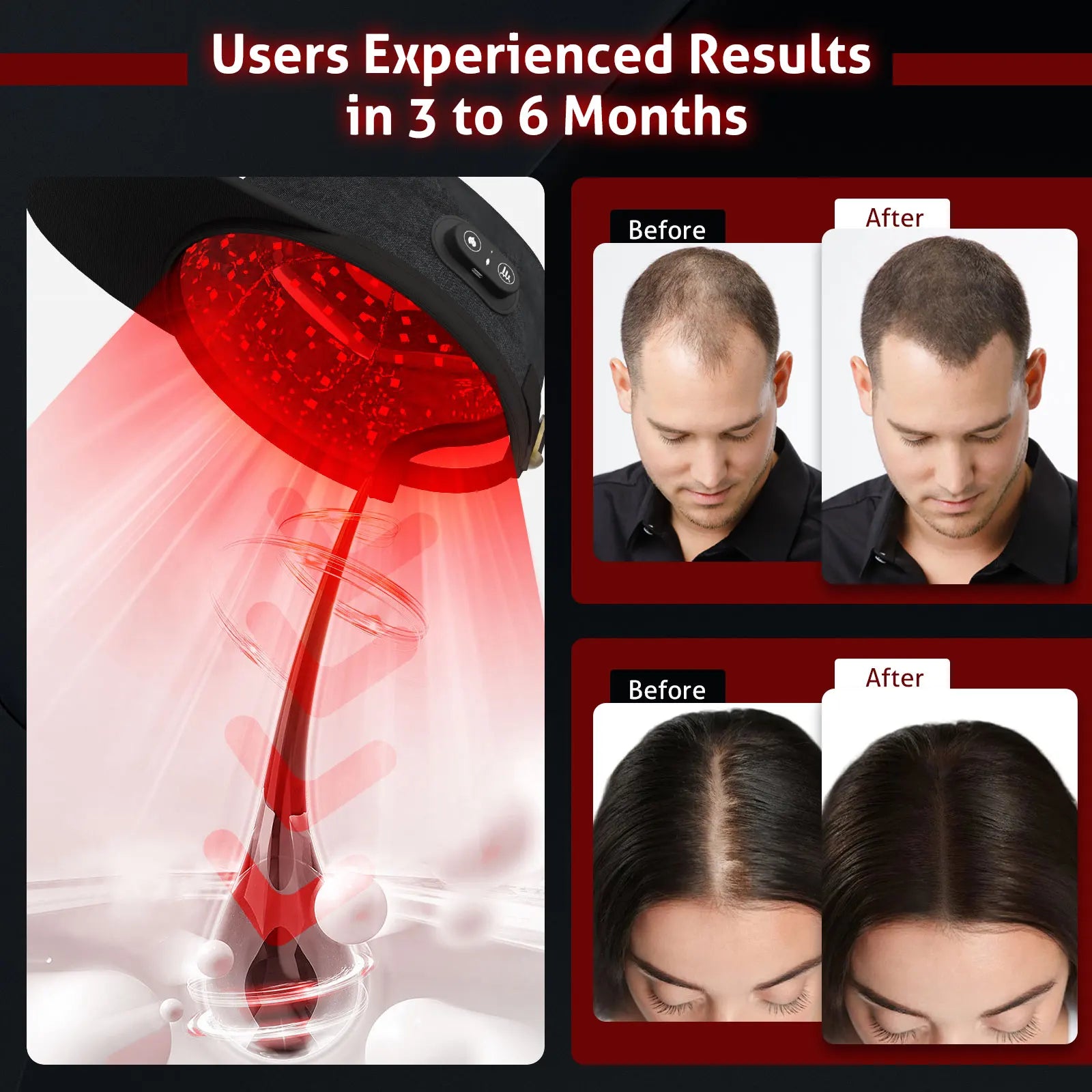 Red Light Hair Regrowth Cap