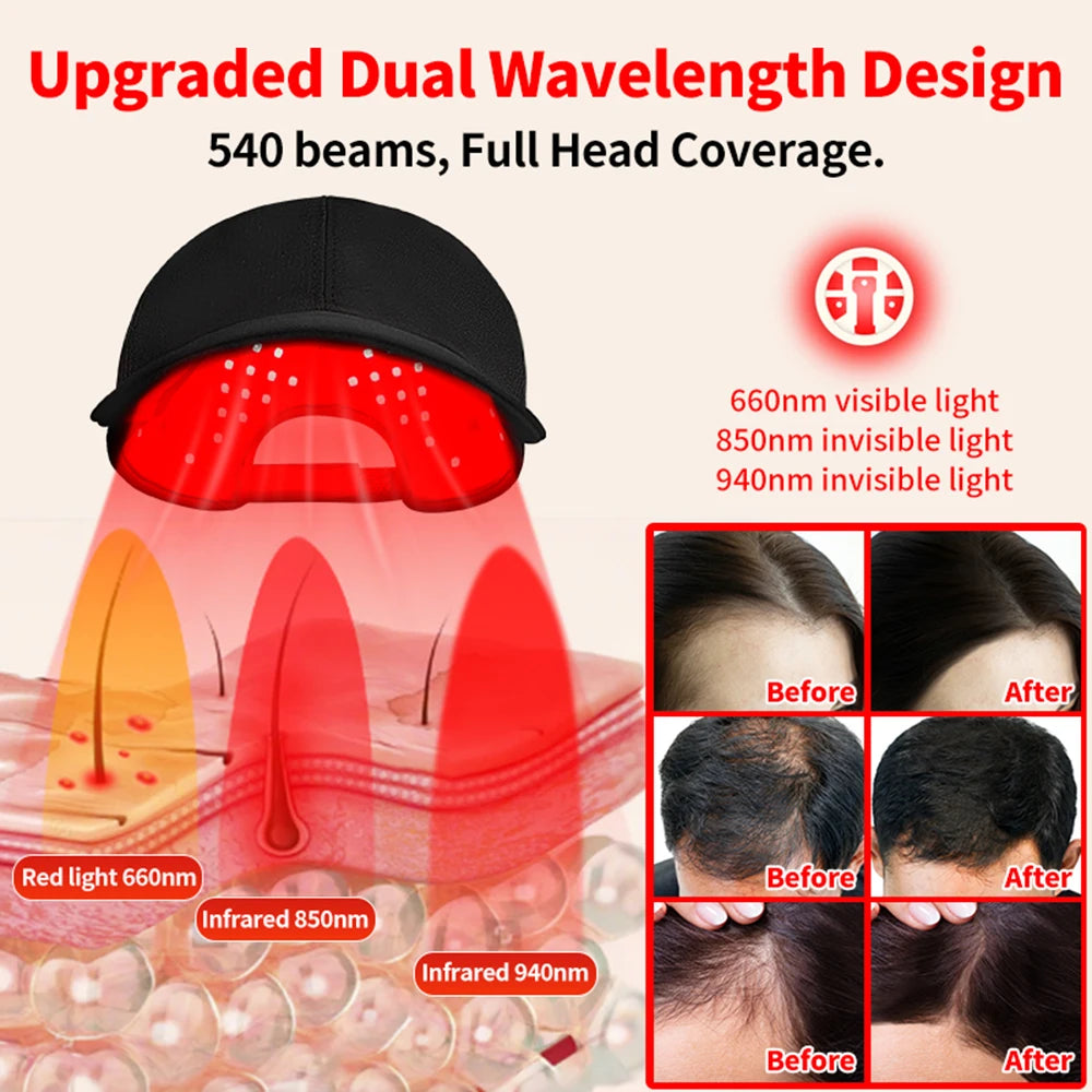Red Light Hair Growth Cap